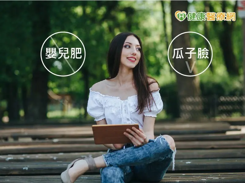 擺脫嬰兒肥!分層口內取脂還你立體小V臉 – 健康醫療網