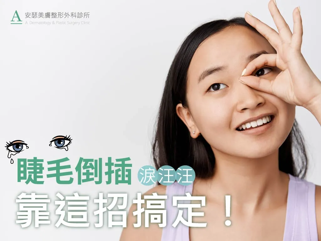 「睫毛倒插」淚汪汪,單眼皮姐妹的逆襲,靠這招搞定!